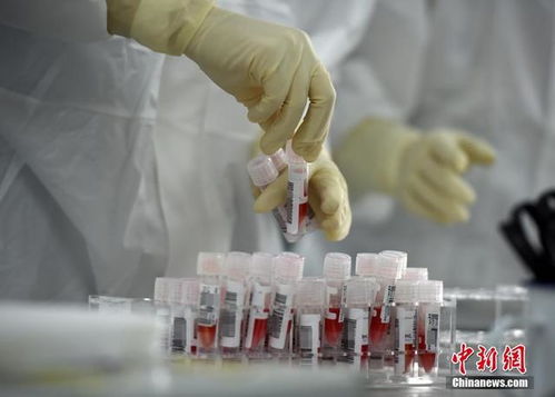 探訪新冠肺炎病毒核酸檢測服務